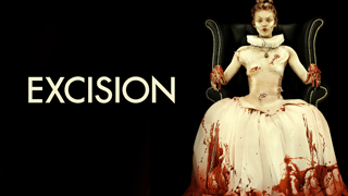 Excision